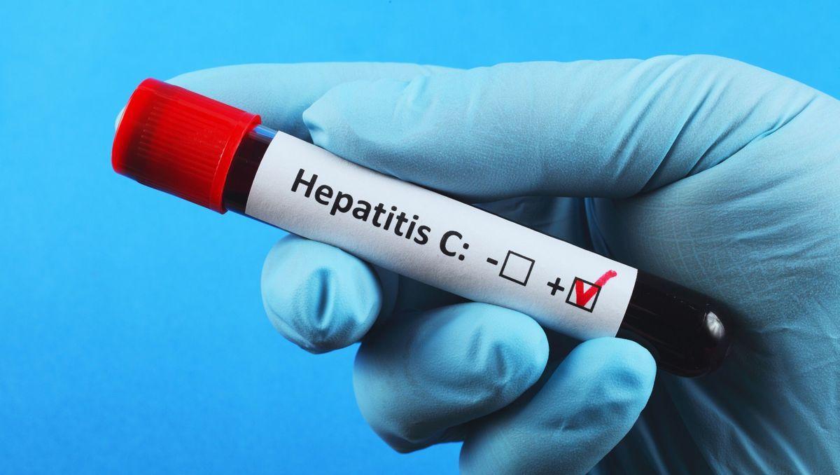 Analyse sanguine medicale sang hepatite c