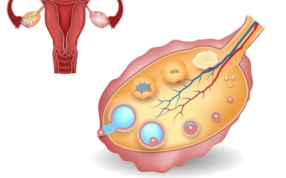 Anovulation booster l ovulation