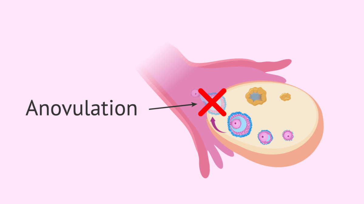 Remèdes naturels contre l'anovulation