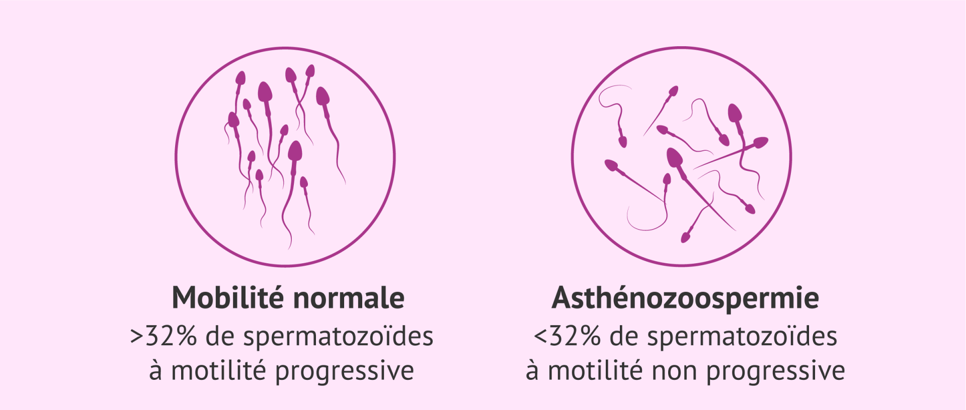 Asthenospermie