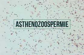 Asthenospermmie