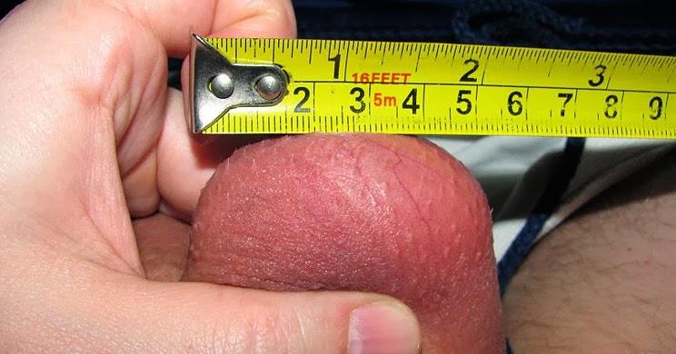 Atrophie testiculaire