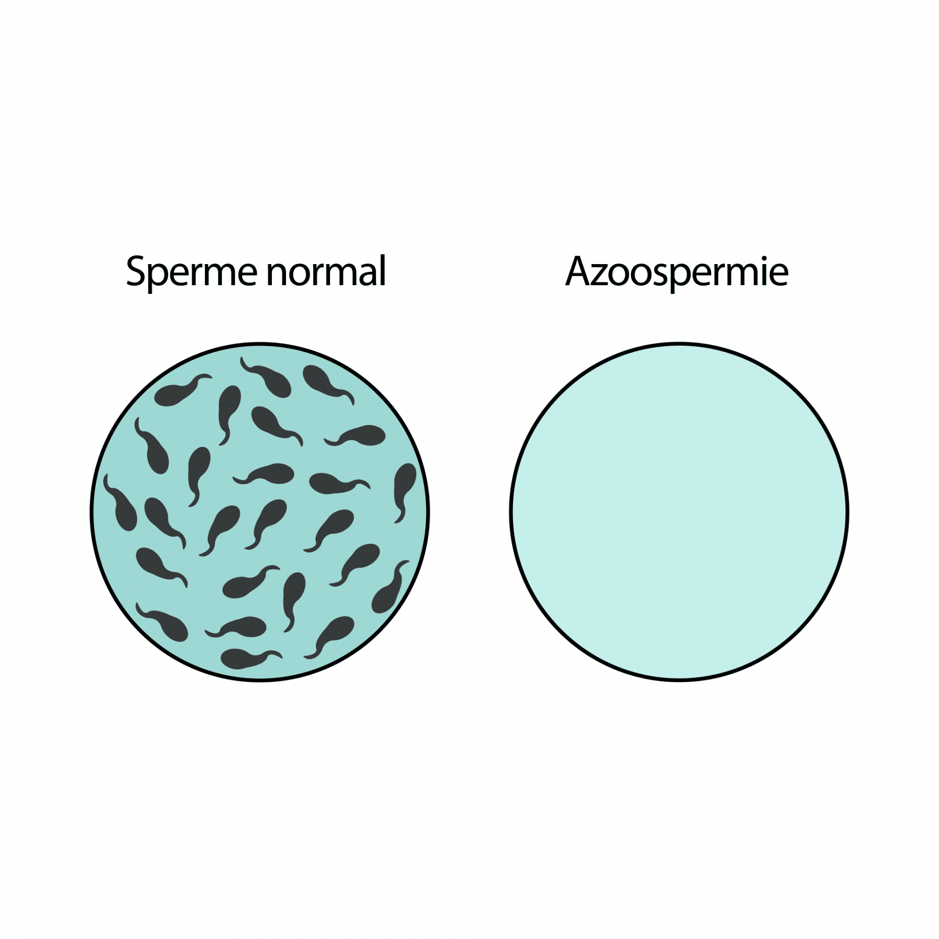 Azoospermie2