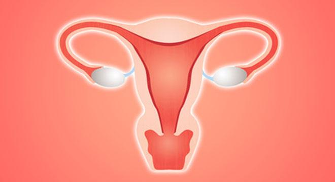 MON KYSTE OVARIEN PEUT-IL DEVENIR UN CANCER?