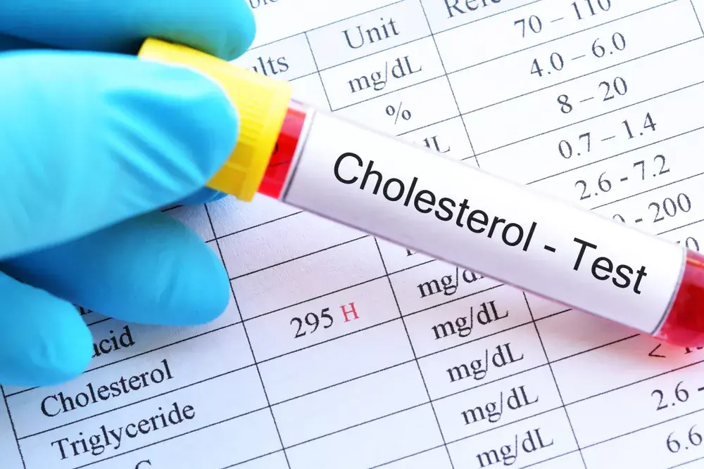 Cholesterol test sang