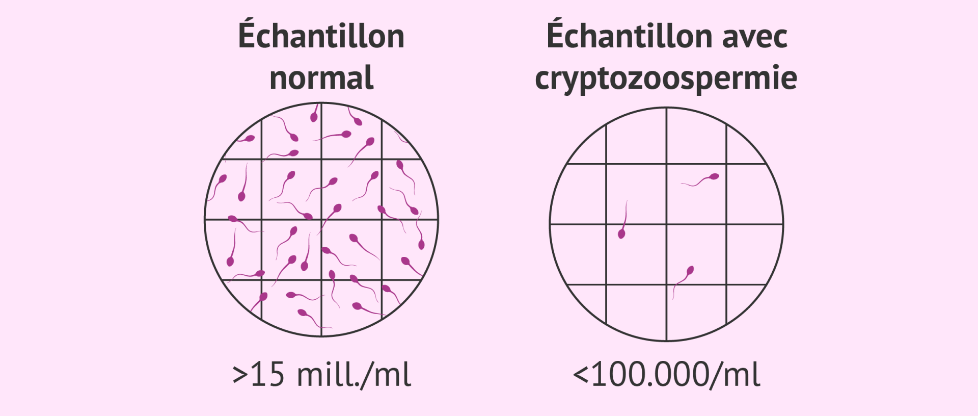 Cryptozoospermie