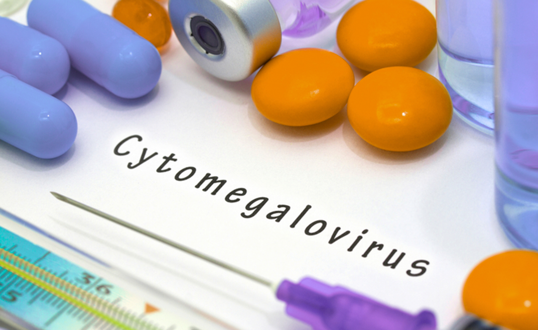 Traitement Naturel Cytomégalovirus