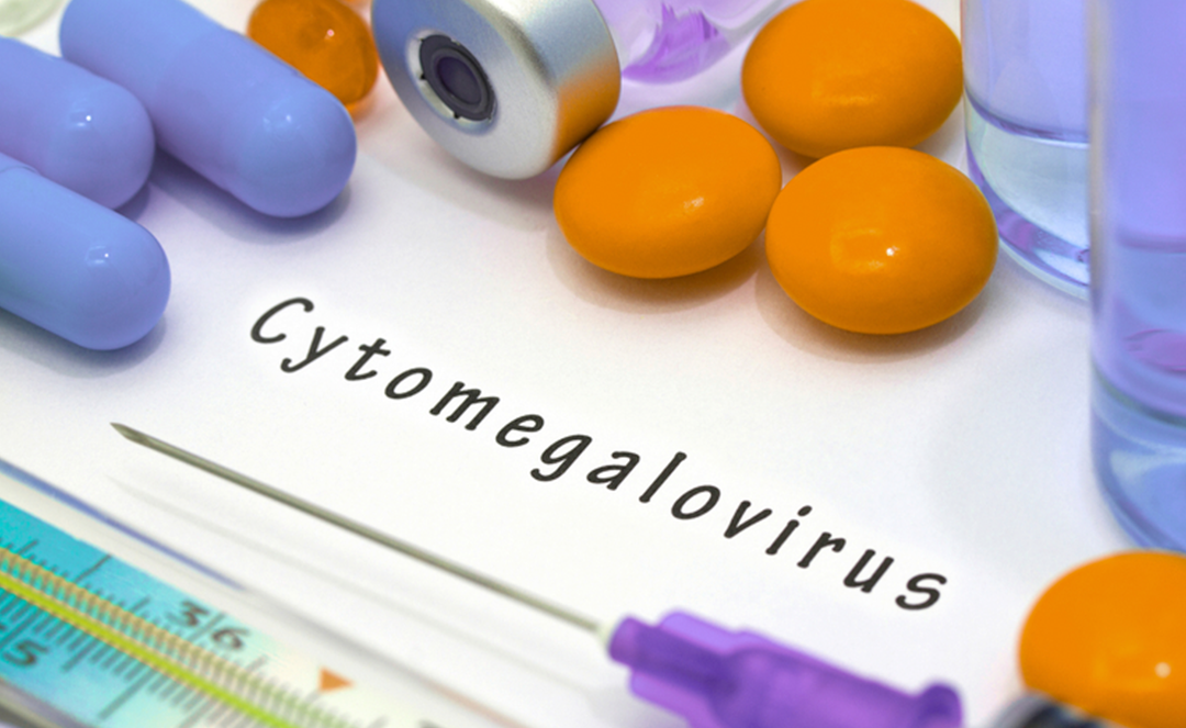 Cytomegalovirus