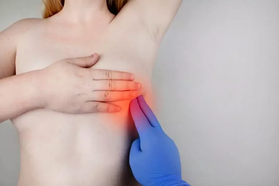 Remèdes naturels contre le cancer du sein