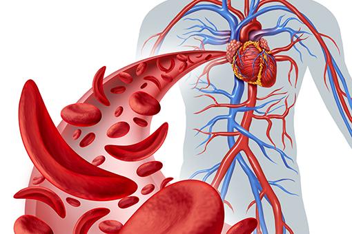 Drepanocytose solution naturelle