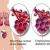 Emphyseme pulmonaire 2