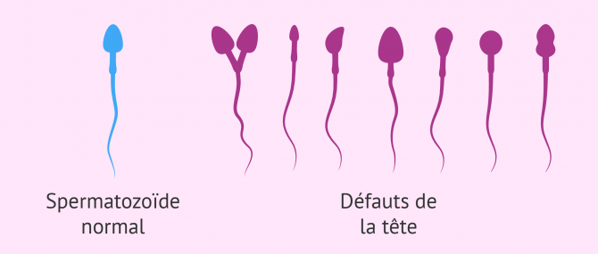 Formes des spermatozoides1