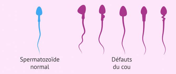 Formes des spermatozoides2