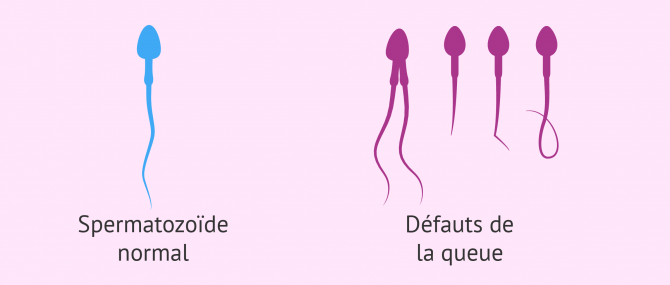 Formes des spermatozoides3
