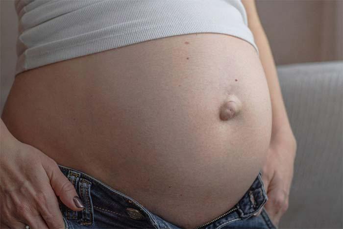 Hernie ombilicale femme enceinte
