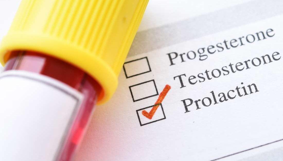 Hyperprolactinemie analyse sanguin sang medical