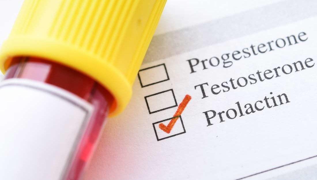 Guérir l'hyperprolactinémie par les plantes