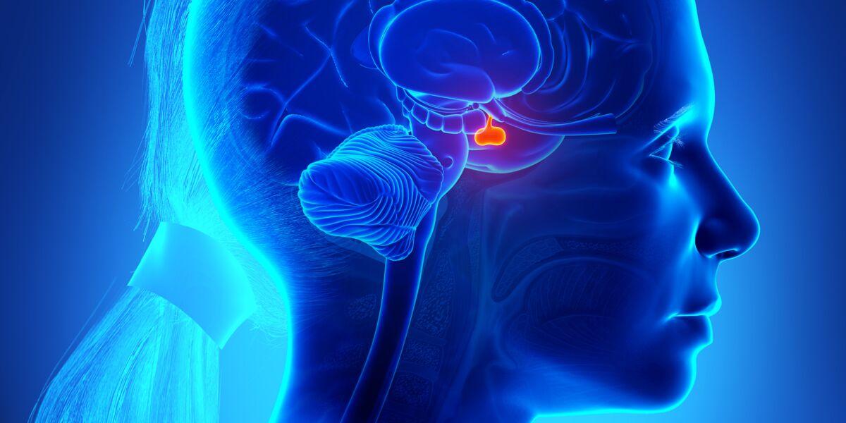 Hypertrophie hypophysaire