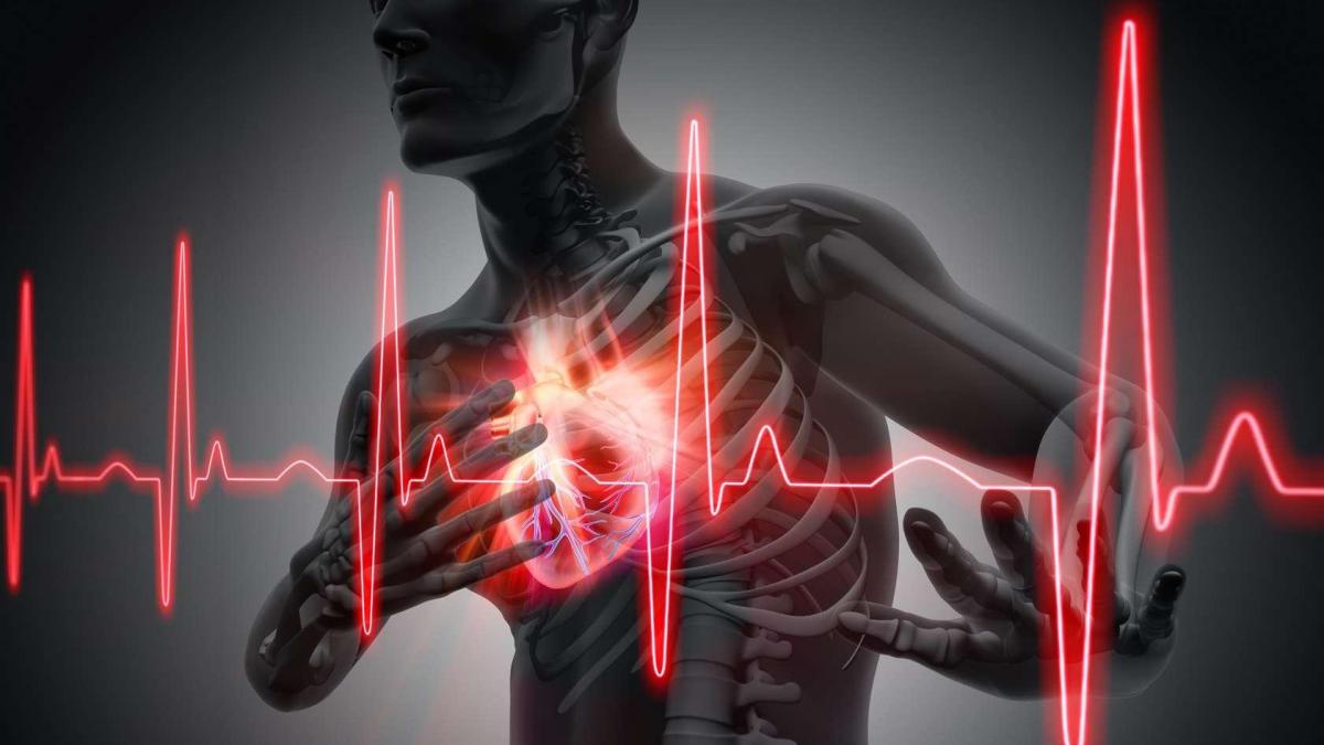Plantes contre l'infarctus du myocarde