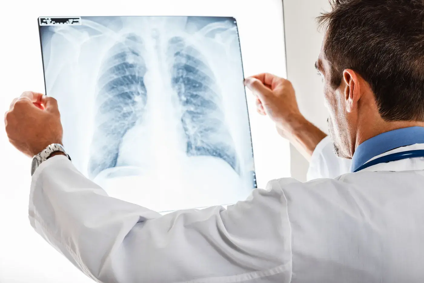 Infection pulmonaire