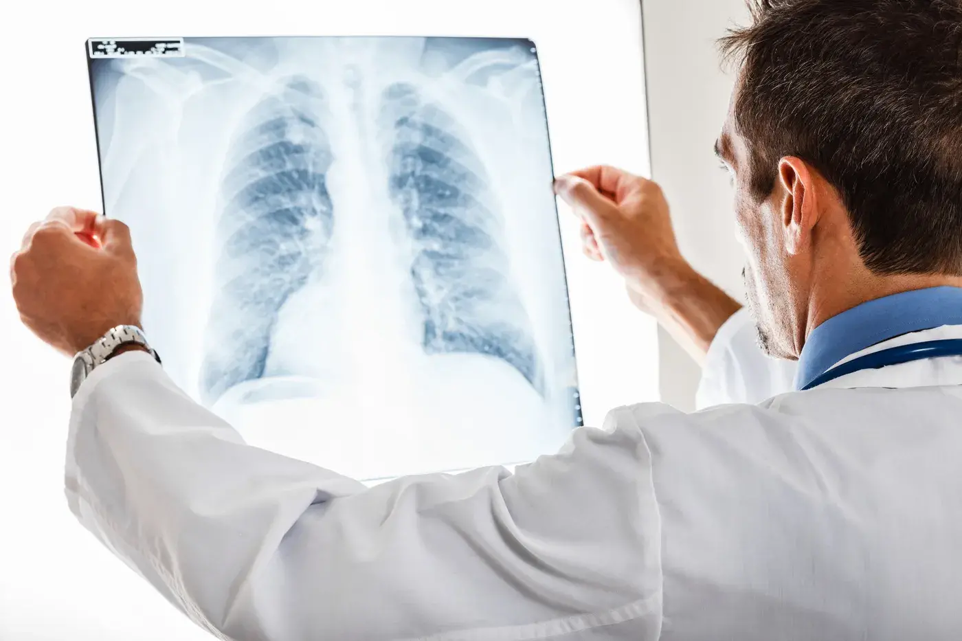 Plantes et remèdes naturels contre les infections pulmonaires