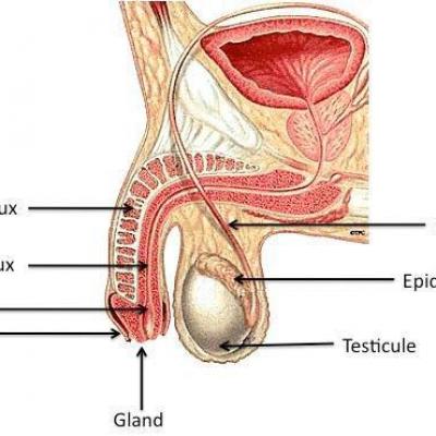 Kyste de l epididyme 1