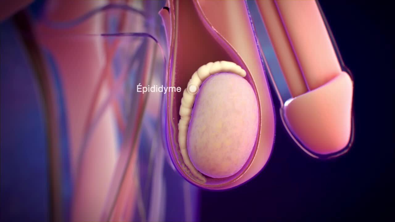 Kyste de l epididyme 2