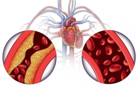 Les plantes qui traitent l hypertension