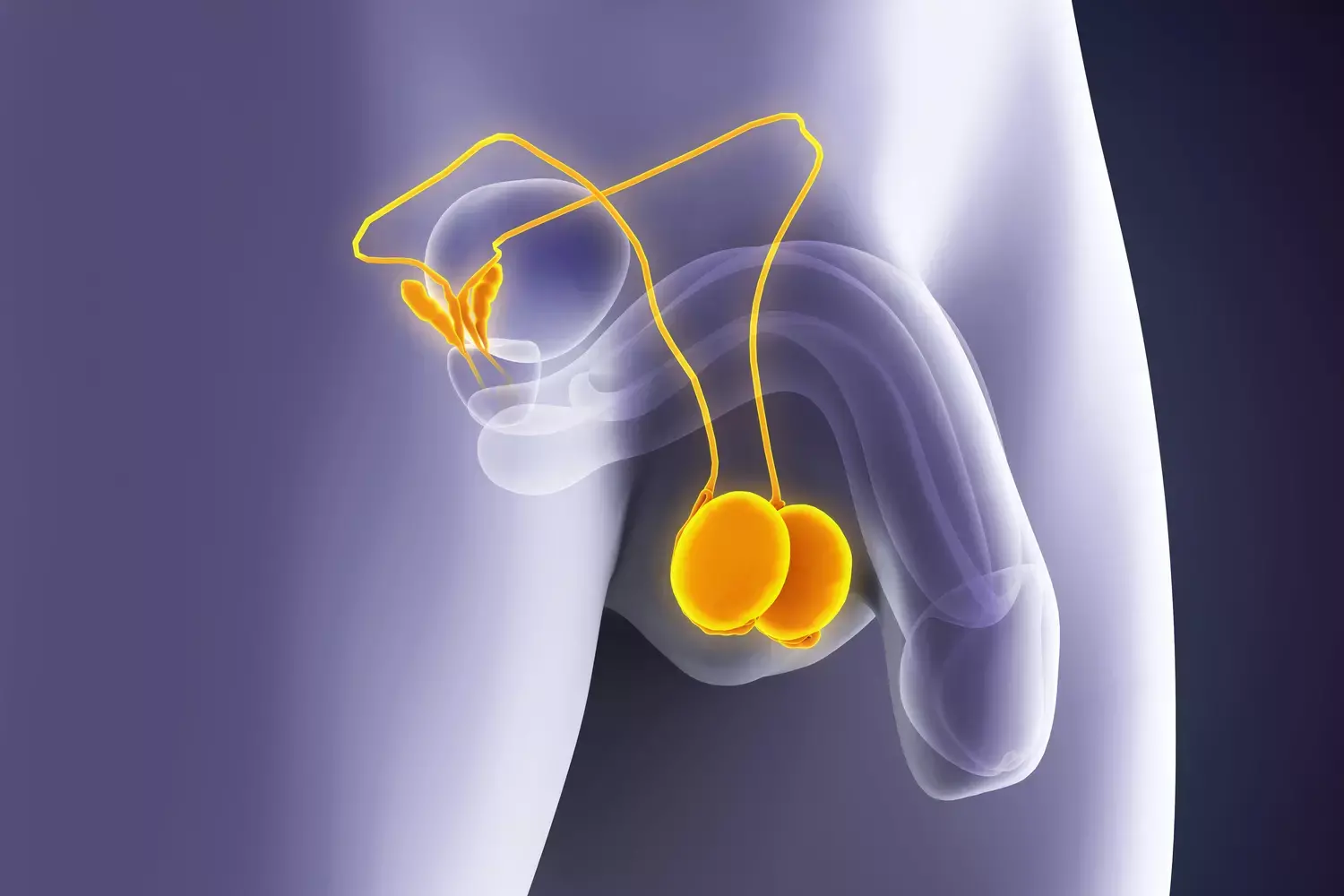 Microlithiase testiculaire