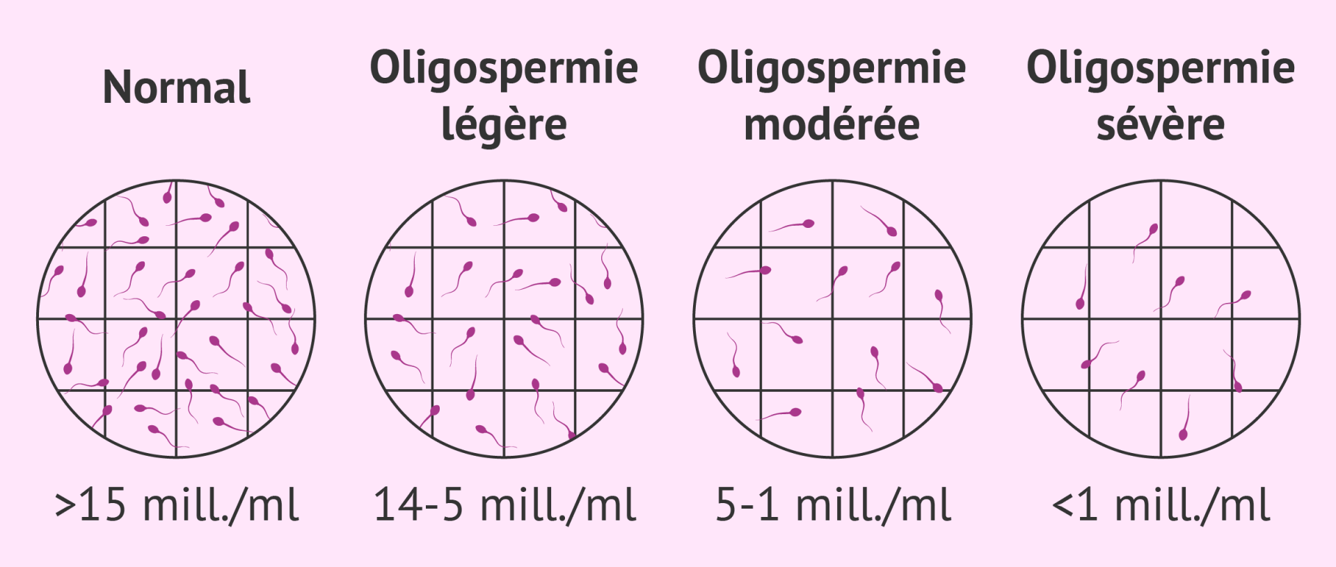 Oligospermie