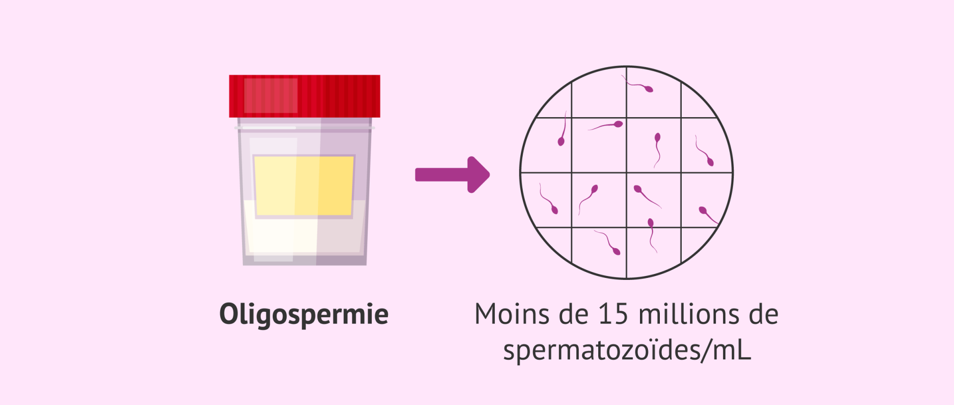 Oligospermie