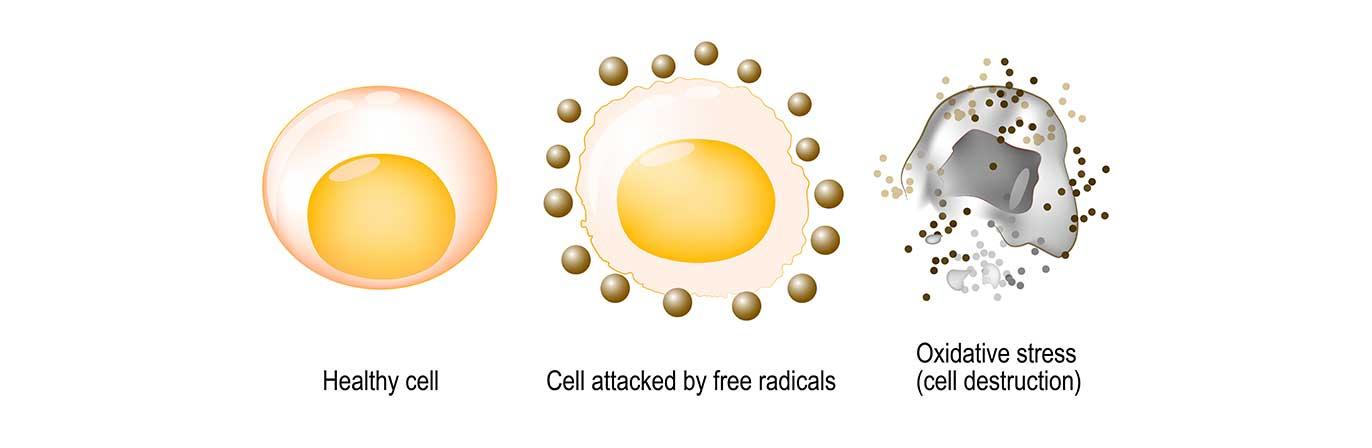 Oxidative stress