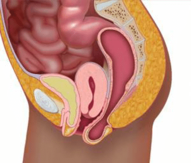 Prolapsus rectal traitement non chirurgical