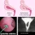 Synechie uterine