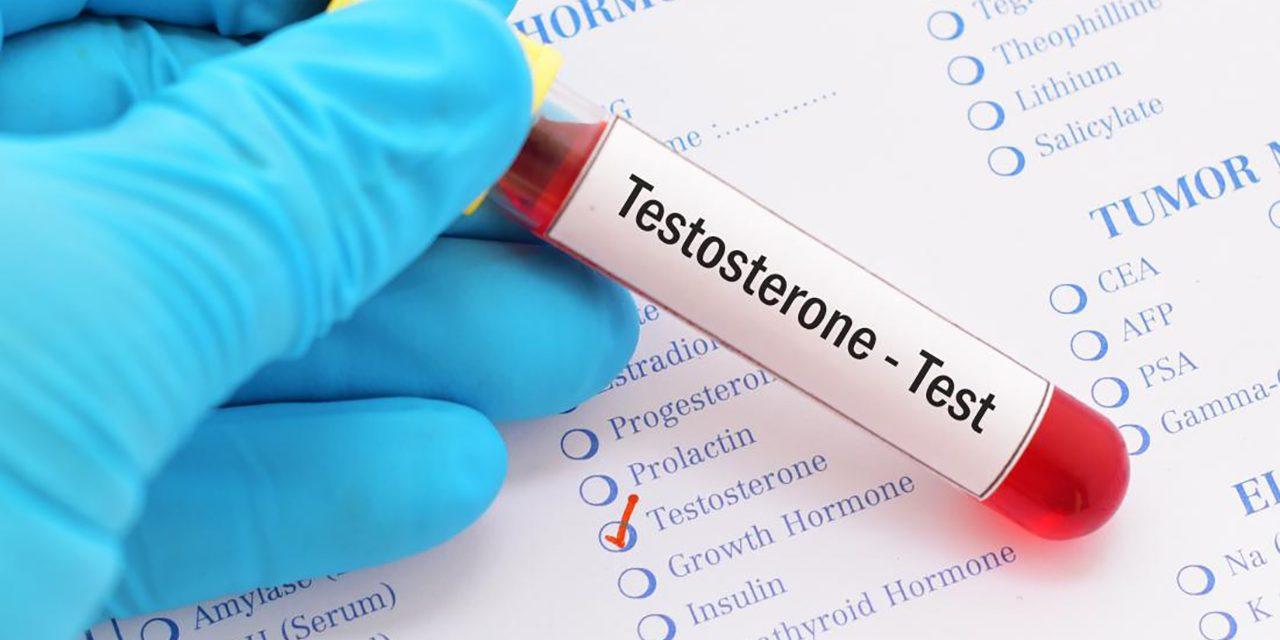 Test de testosterone