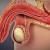 Testicules 2