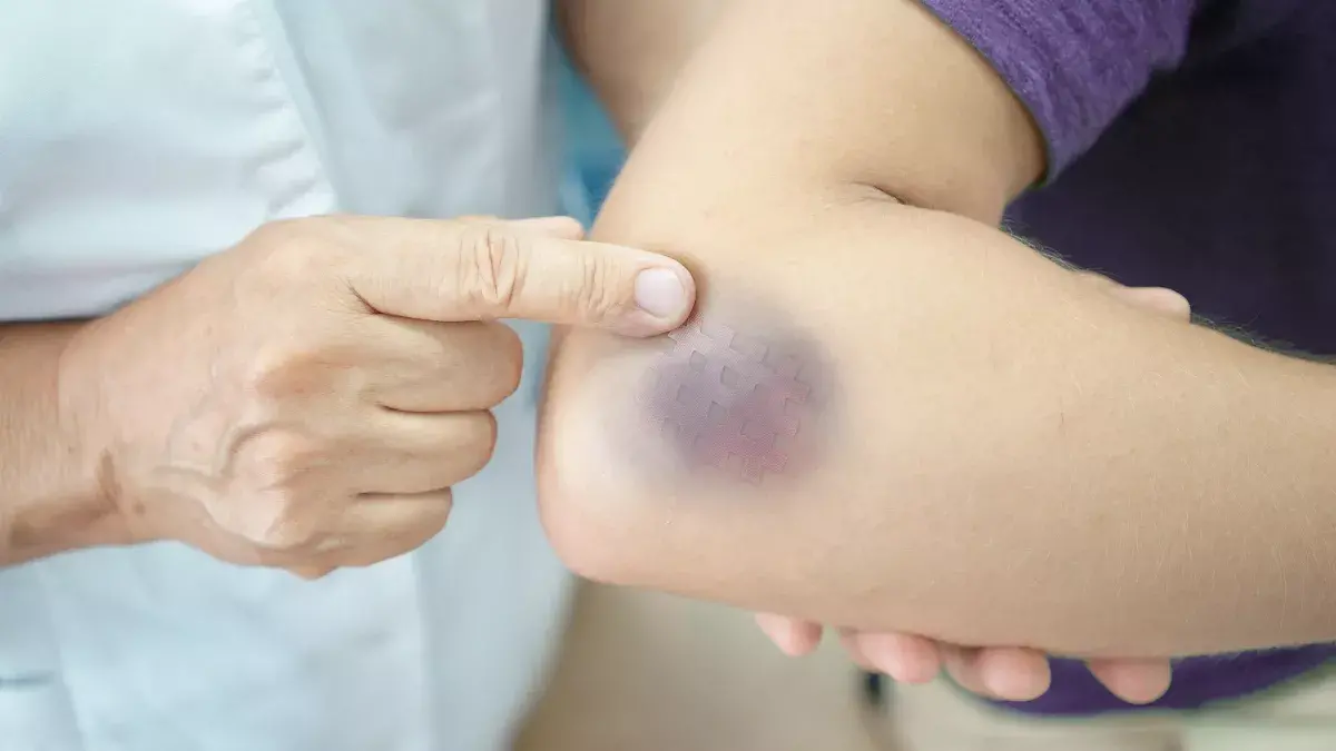Remède Naturel Pour Thrombopénie