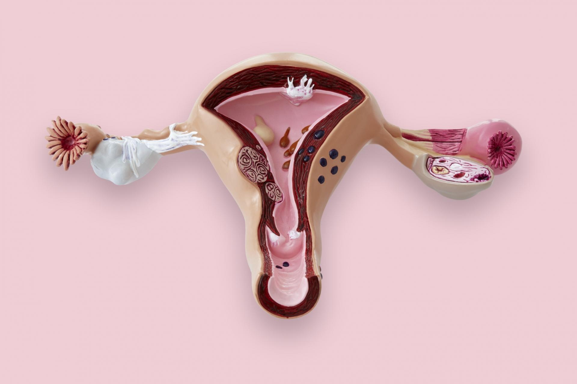 Uterus