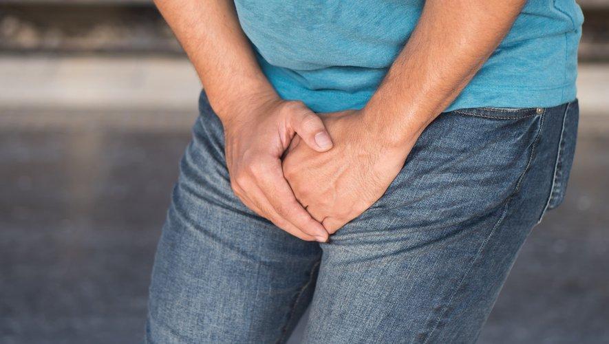Tisane efficace pour guérir la varicocèle sans opération